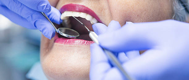 Best Emergency Tooth Extraction in Merkel, TX